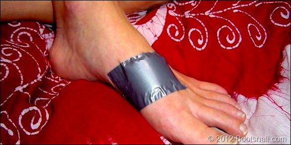 Duct-tape-dressing-for-tropical-sores
